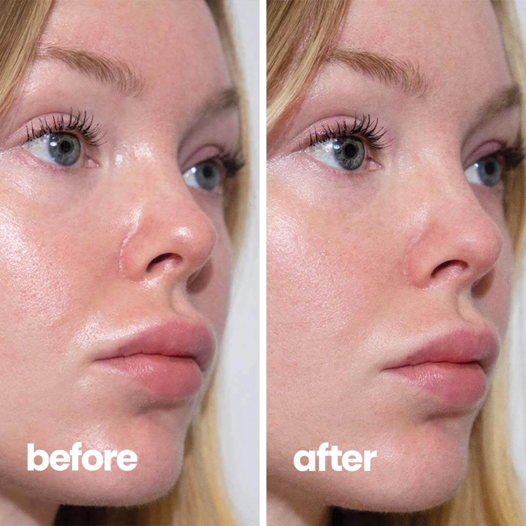 Blotberry™ Blotting Compact